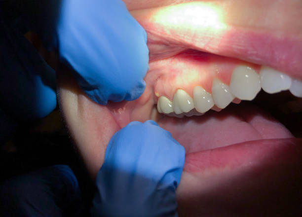 Best Emergency Root Canal Treatment in Shoreacres, TX