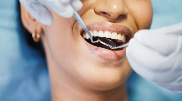 Best Same-Day Emergency Dentist in Shoreacres, TX