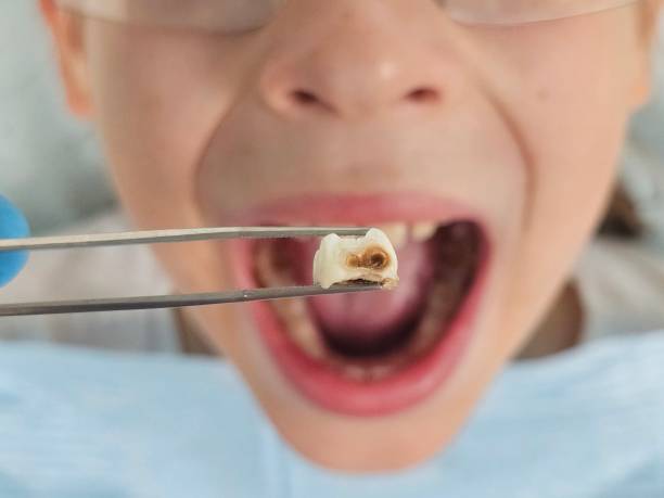 Best Pediatric Emergency Dentist in Shoreacres, TX