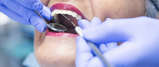 Best Emergency Treatment for Toothache in Shoreacres, TX
